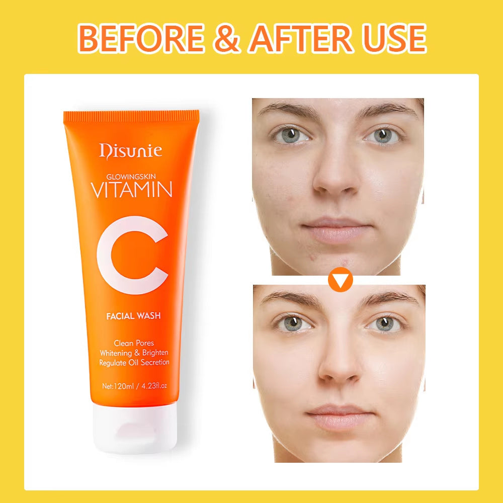 Limpiador facial Disunie con vitamina C y aminoácidos: iluminador y control de grasa (100 ml)