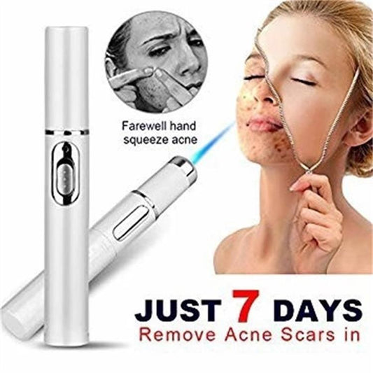 LuxuryGlow Blue Light Acne Laser Pen – Wrinkle & Scar Removal Skin Therapy Device