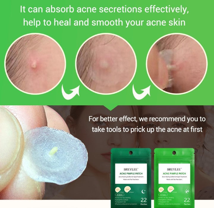 BREYLEE Ultra-Thin Tea Tree Acne Patch – Pimple Healing & Scar Care