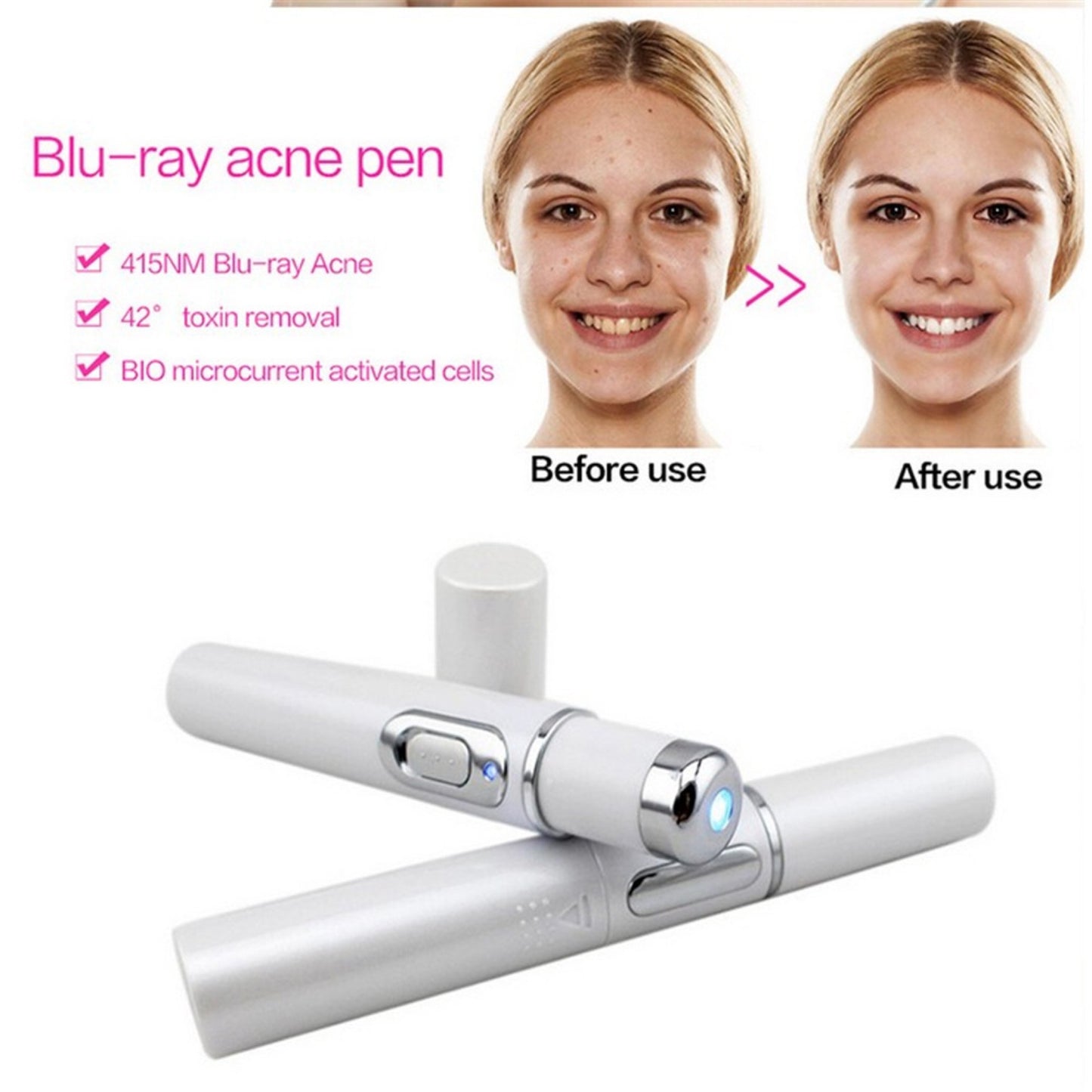 Lápiz láser para acné LuxuryGlow con luz azul: dispositivo de terapia cutánea para eliminar arrugas y cicatrices