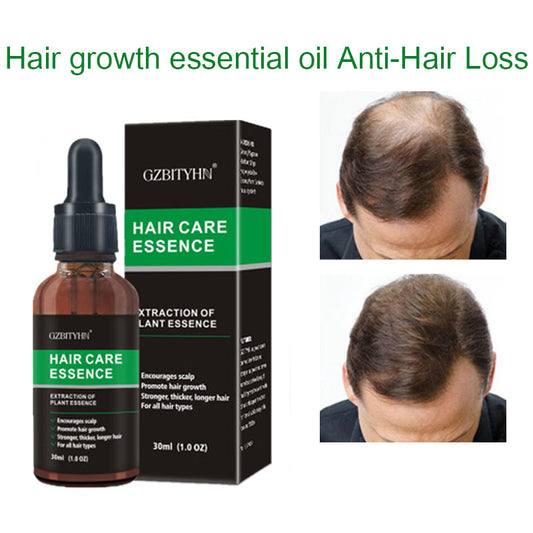 GZBITYHN Hair Growth Oil – Nourishing Essential Oil for Scalp & Hair Regrowth