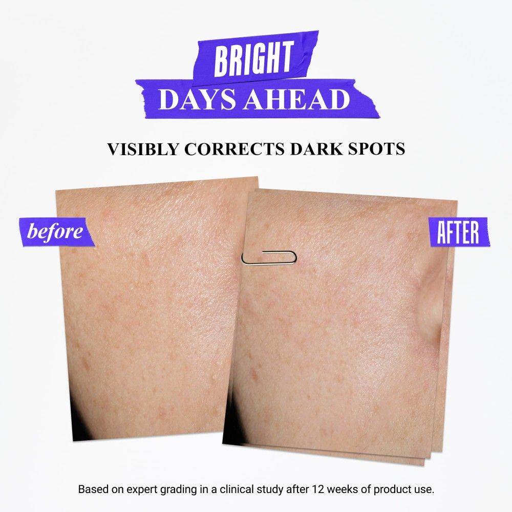 KIEHL’S Clearly Corrective™ Dark Spot Solution – Advanced Brightening Serum for Even, Radiant Skin