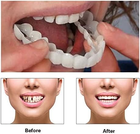 Snap-On Veneers Teeth Kit for Women & Men | Natural Tooth Replacement, Comfortable Cosmetic Dentures