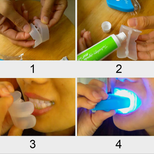 Kit de blanqueamiento dental LED LuxuryGlow con gel: elimina manchas y blanquea rápidamente