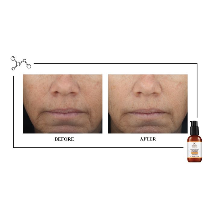 KIEHL’S Powerful Strength Line Reducing Concentrate – Vitamin C Anti-Aging Serum with Hyaluronic Acid for Radiant, Smooth Skin