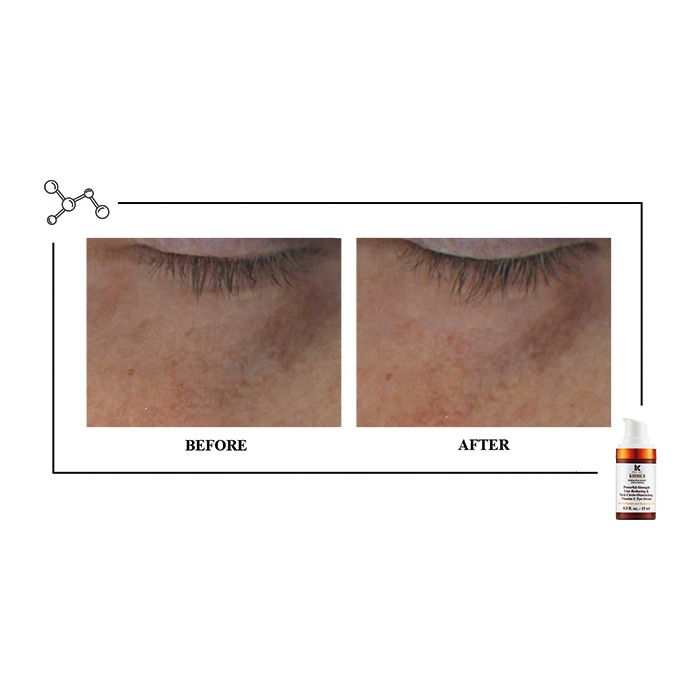 Powerful-Strength Vitamin C Eye Serum – Dark Circle & Wrinkle Reducer