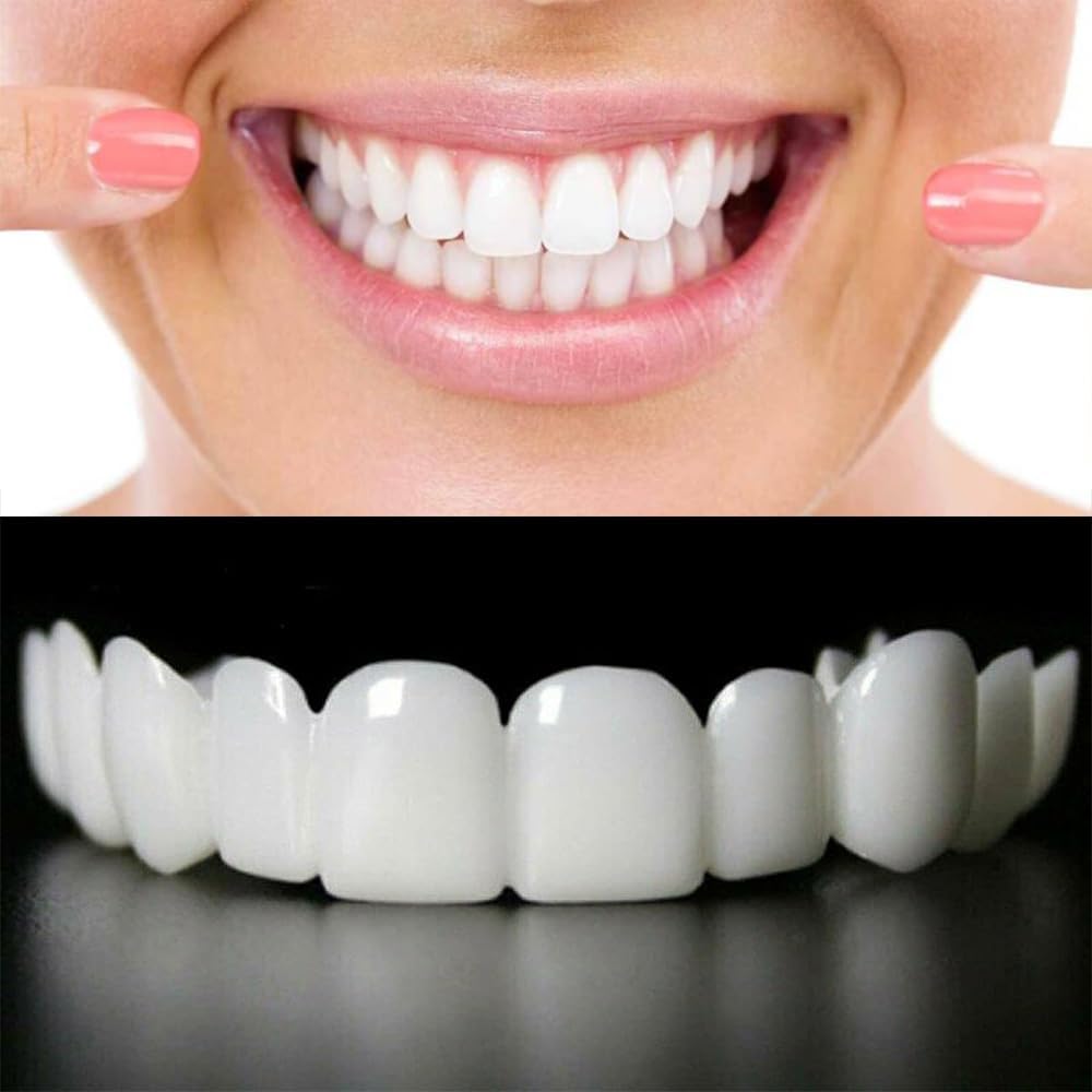 Snap-On Veneers for Men & Women – Moldable False Teeth Replacement Kit with Grinding Guard, Natural Look Temporary Dentures