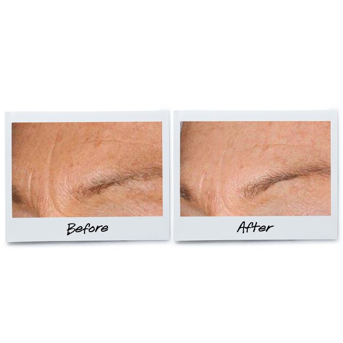 KIEHL’S Ultra Light Daily UV Defense Anti-Pollution Sunscreen SPF 50 PA++++ – Non-Greasy, Hydrating Sun Protection for All Skin Types