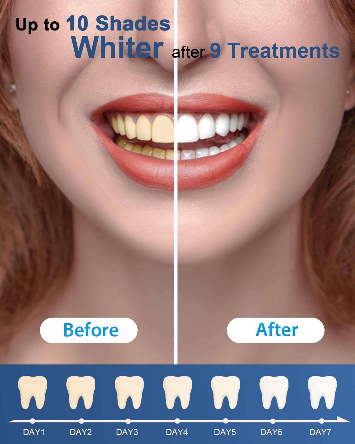 Bolígrafos de gel blanqueadores MySmile: paquete de 3 para dientes sensibles, resultados rápidos