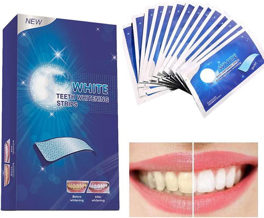 Ceonam Teeth Whitening Strips – 28 Paraben-Free Strips (14 Pack), Enamel-Safe, Sensitivity-Free, Removes Deep Stains from Coffee, Tea & Smoking