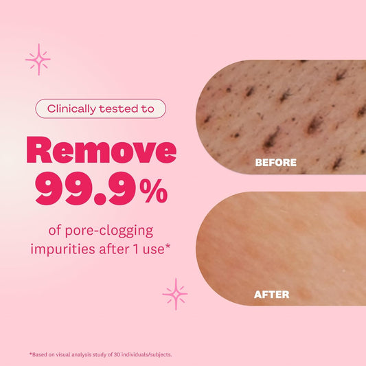 The Face Shop Rice Water Bright Foaming Facial Cleanser | Hydrating, Vegan & Gentle Korean Skincare