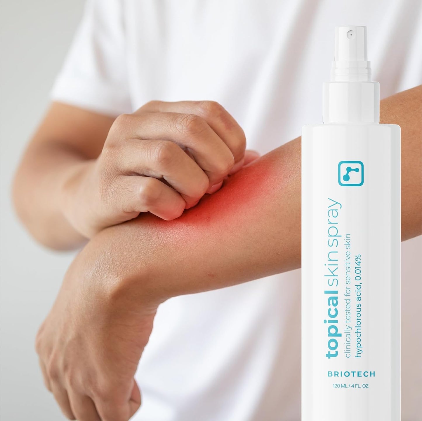 BRIOTECH Hypochlorous Acid Skin Spray – 8oz Soothing Facial & Body Mist for Sensitive Skin, Redness & Irritation Relief