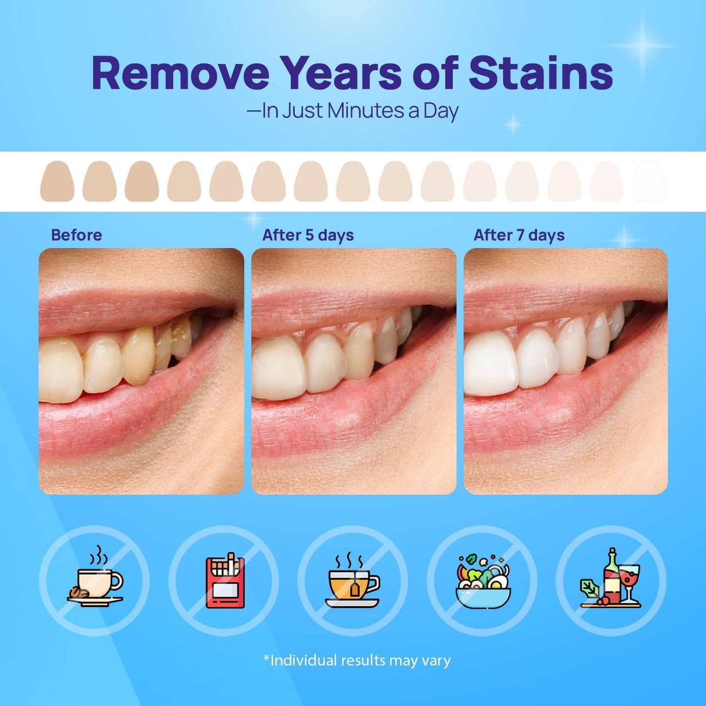 Whitebite Pro Teeth Whitening Strips | 28 Strips (14 Treatments) | Enamel-Safe, Non-Slip & Sensitive Teeth Friendly