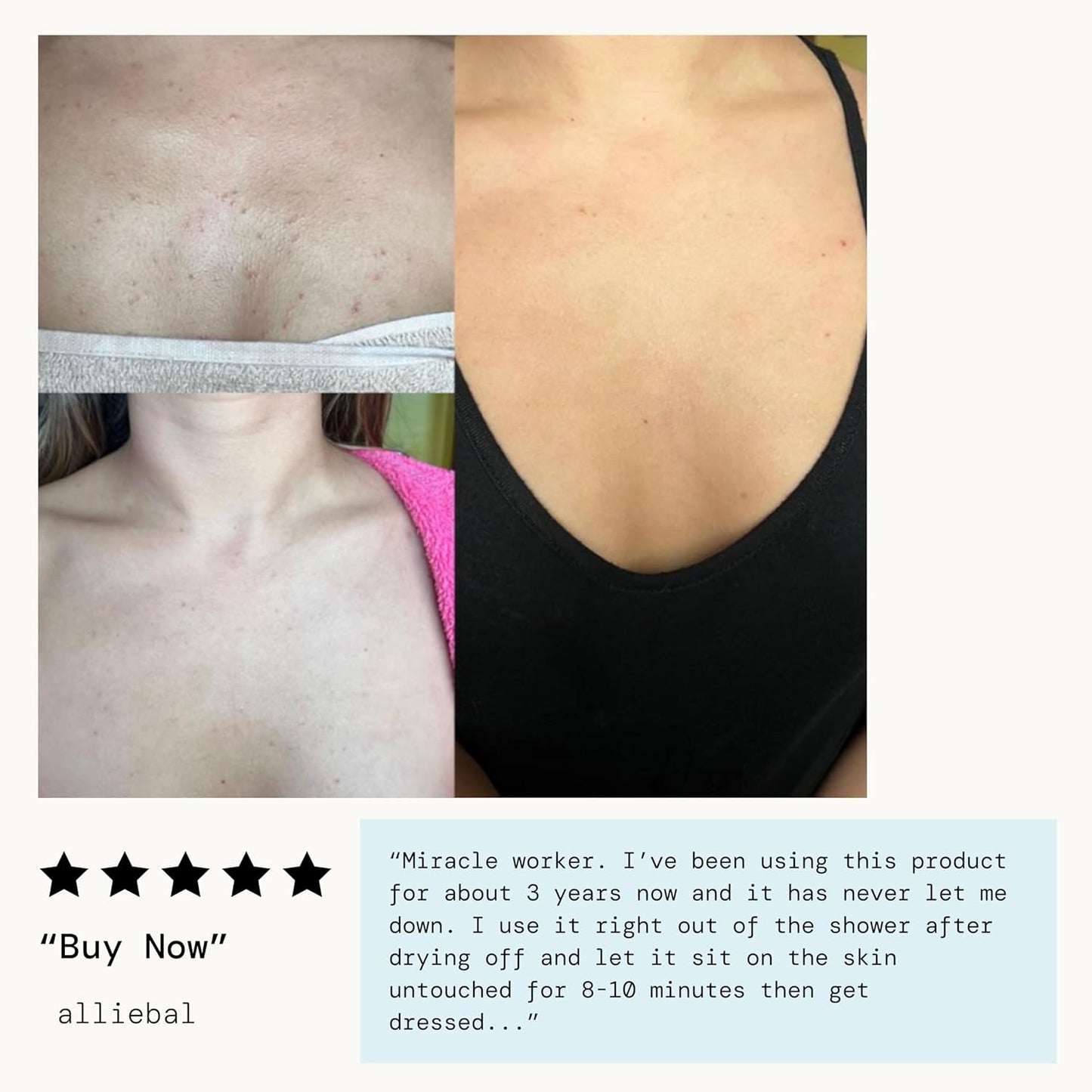 Pacifica Bacne Acne Cleanser Spray – 2% Salicylic Acid Body Mist for Back, Chest & Body Acne | Niacinamide & Aloe | Vegan & Dermatologist Tested – 6oz