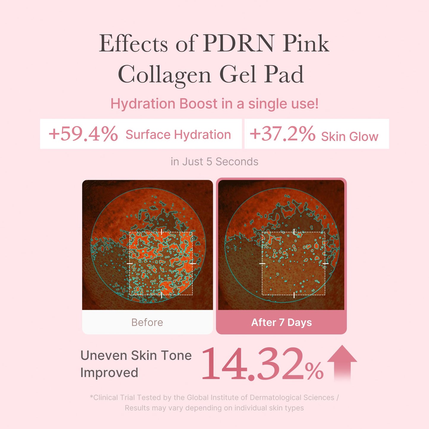 Medicube Salmon DNA PDRN Pink Collagen Jelly Pad – Korean Gel Toner Pads with Niacinamide, Retinol & Madecassoside for Radiance, Soothing & Uneven Skin Tone (70 Pads)