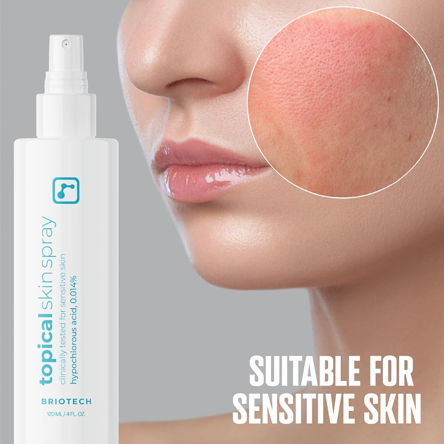 BRIOTECH Hypochlorous Acid Skin Spray – 8oz Soothing Facial & Body Mist for Sensitive Skin, Redness & Irritation Relief