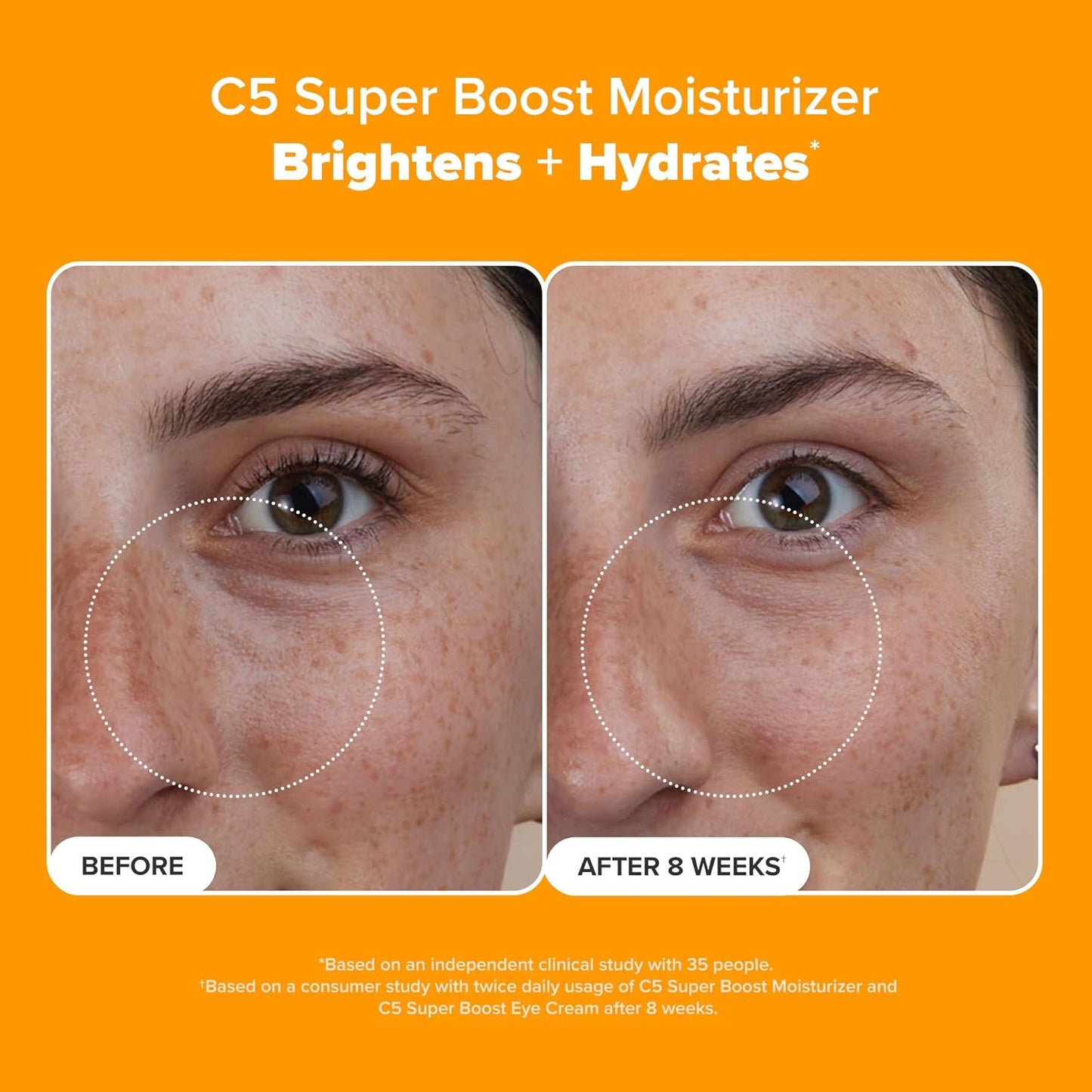 Paula's Choice C5 Super Boost Moisturizer – 5% Vitamin C & Squalane, Brightening Daily Face Lotion