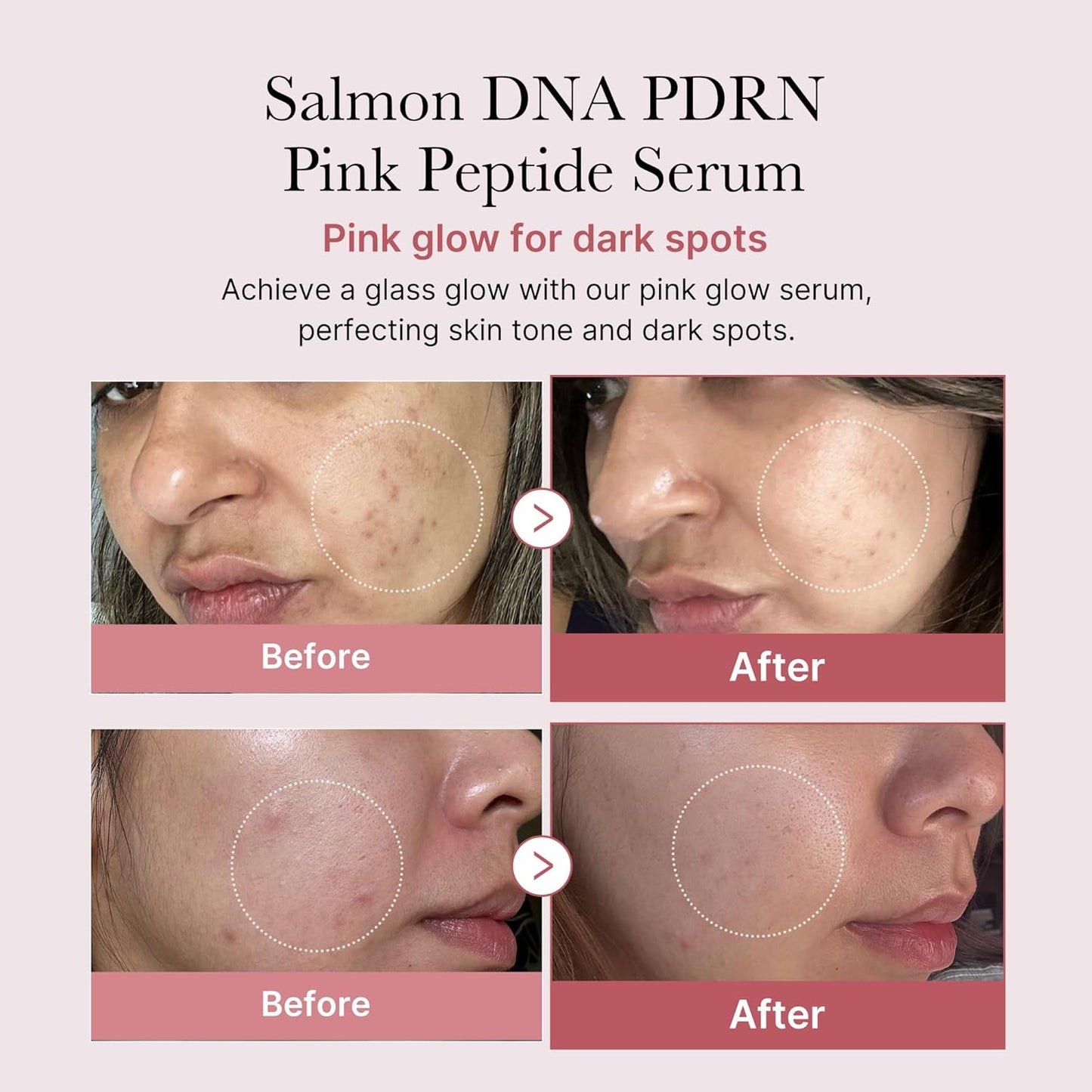 MEDICUBE PDRN Pink Peptide Serum | Skin Brightening & Firming Care