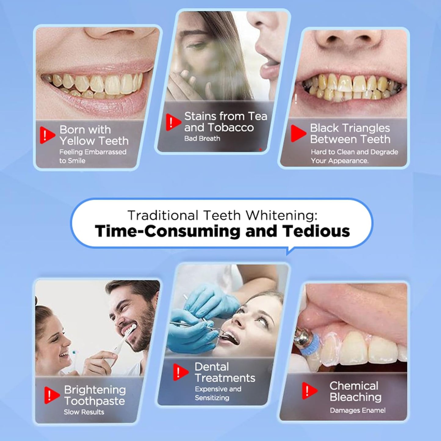 Teeth Whitening Strips – 28 Strips (14 Treatments) | Mint Flavor | Safe & Effective Whitening