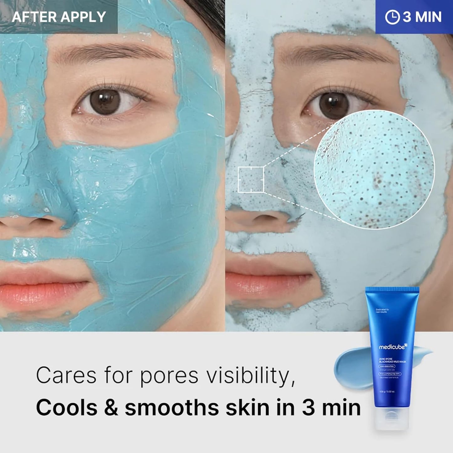 Medicube Zero Pore Blackhead Mud Mask | Quick 3-Min Detox with AHA, BHA, PHA | Pore Tightening, Cooling Korean Clay Mask (3.52 oz)