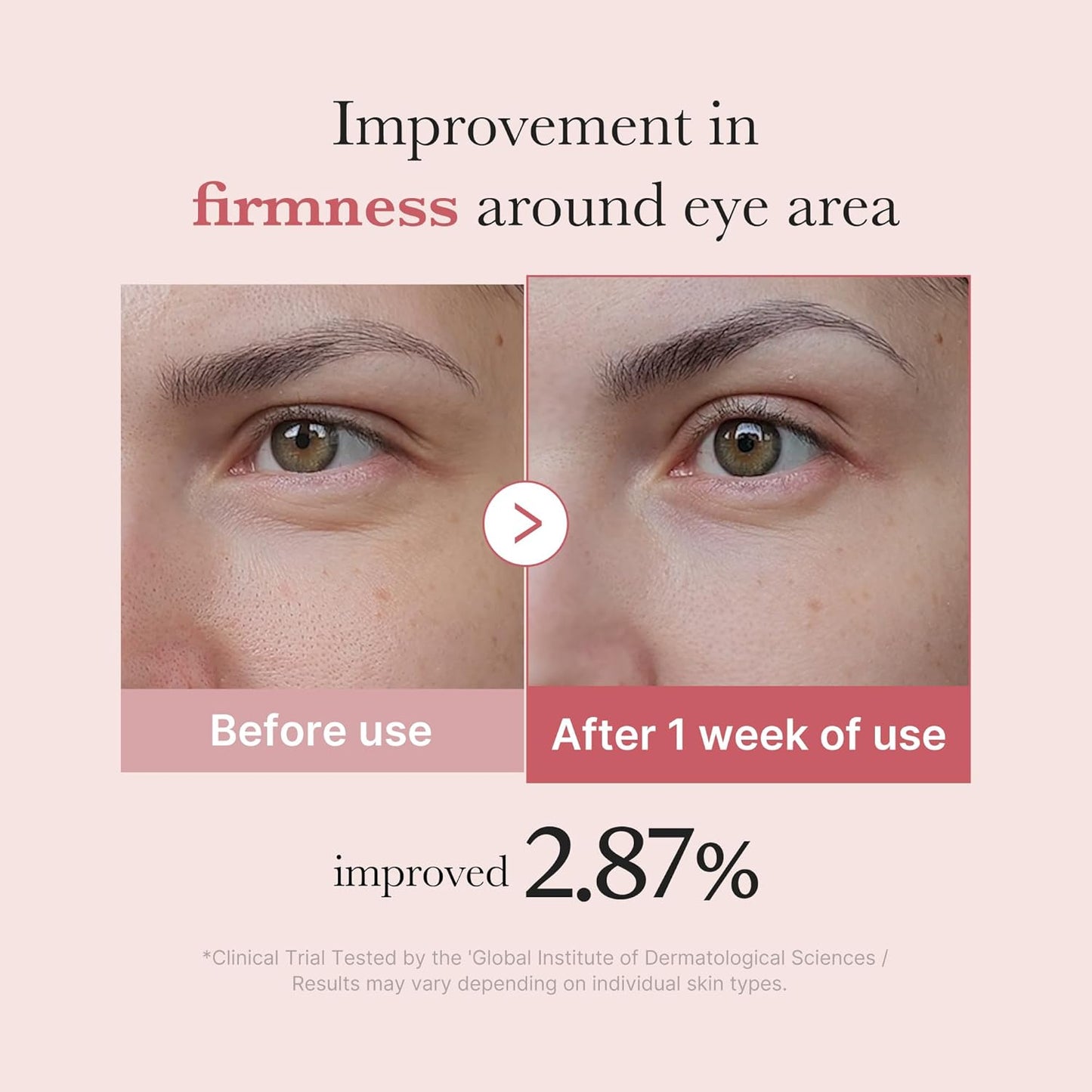Medicube Salmon DNA PDRN Pink Peptide Eye Serum with Retinol & Niacinamide | Korean Eye Care for Fine Lines, Puffiness & Uneven Skin Tone (30ml / 1.01 fl oz)