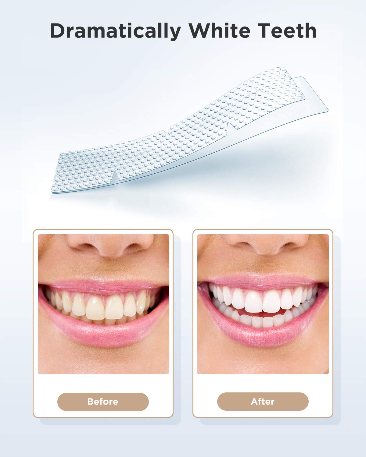 Gloridea Teeth Whitening Strips – 28 Strips (14 Treatments), Mint Flavor, Sensitivity-Free Formula, Fast Stain Removal