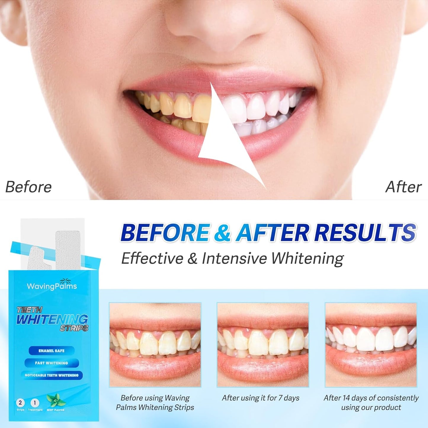 Waving Palms Teeth Whitening Strips – 28 Strips (14 Treatments) | Enamel-Safe, Fast Stain Removal & Professional Whitening Kit