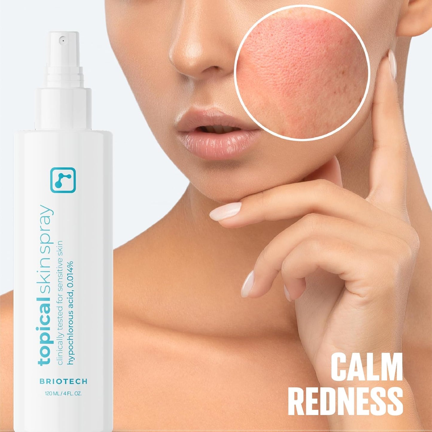 BRIOTECH Hypochlorous Acid Skin Spray – 8oz Soothing Facial & Body Mist for Sensitive Skin, Redness & Irritation Relief