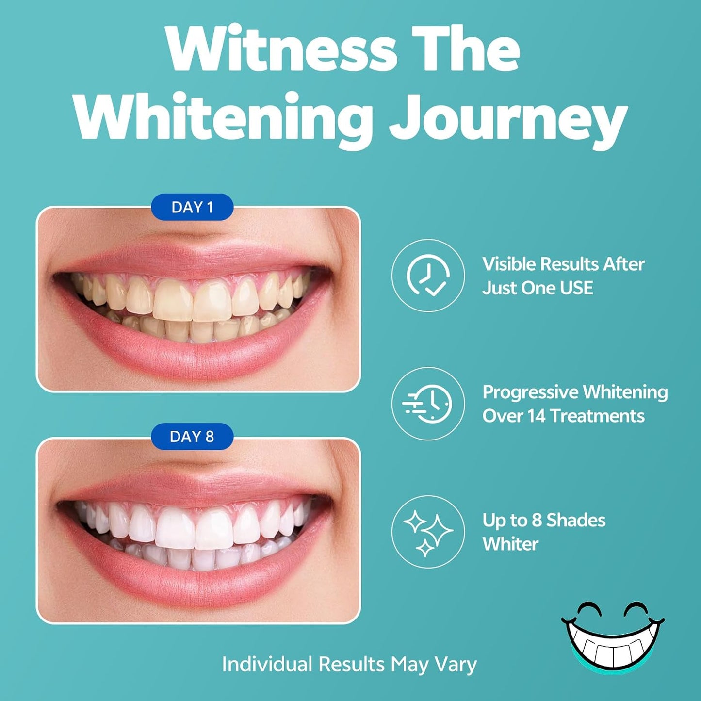SmileFreshness Teeth Whitening Strips Kit (14 Treatments, 28 Strips) – Clinically Proven, Enamel-Safe, Reduced Sensitivity, Coconut-Infused Whitening