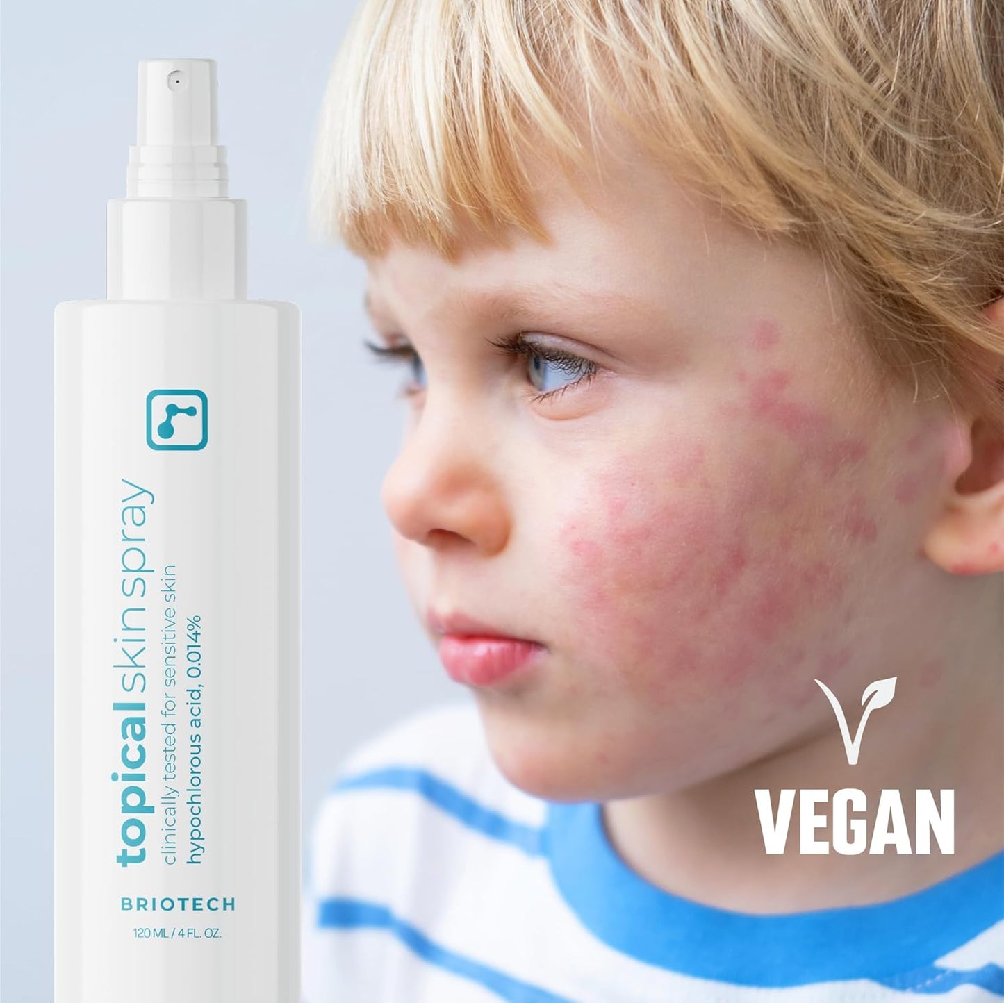 BRIOTECH Hypochlorous Acid Skin Spray – 8oz Soothing Facial & Body Mist for Sensitive Skin, Redness & Irritation Relief