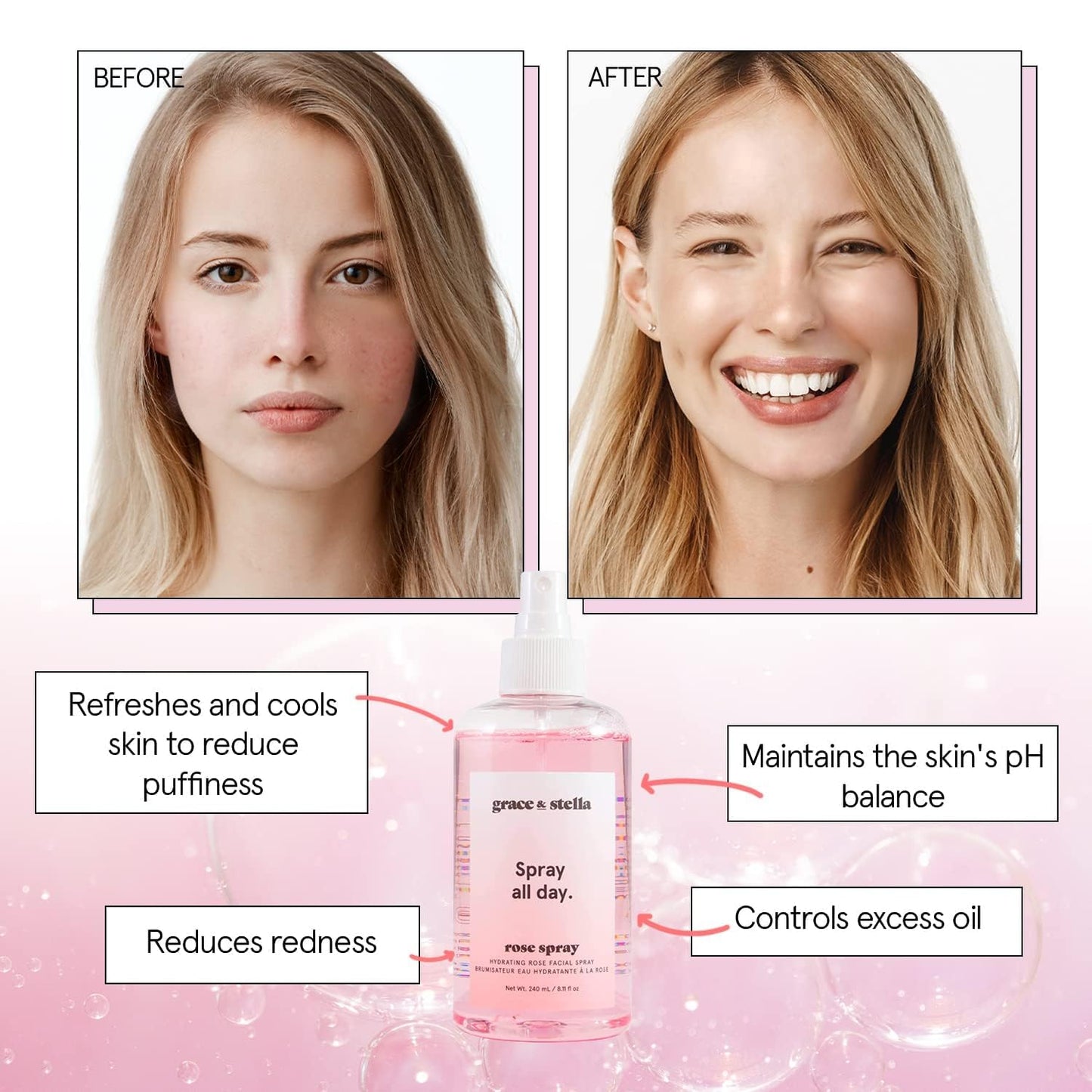 Grace & Stella Rose Water Facial Spray – Award-Winning Hydrating Rose Mist with Hyaluronic Acid for Radiance, Redness & Oil Control – Vegan Toner & Makeup Setting Spray – 240ml