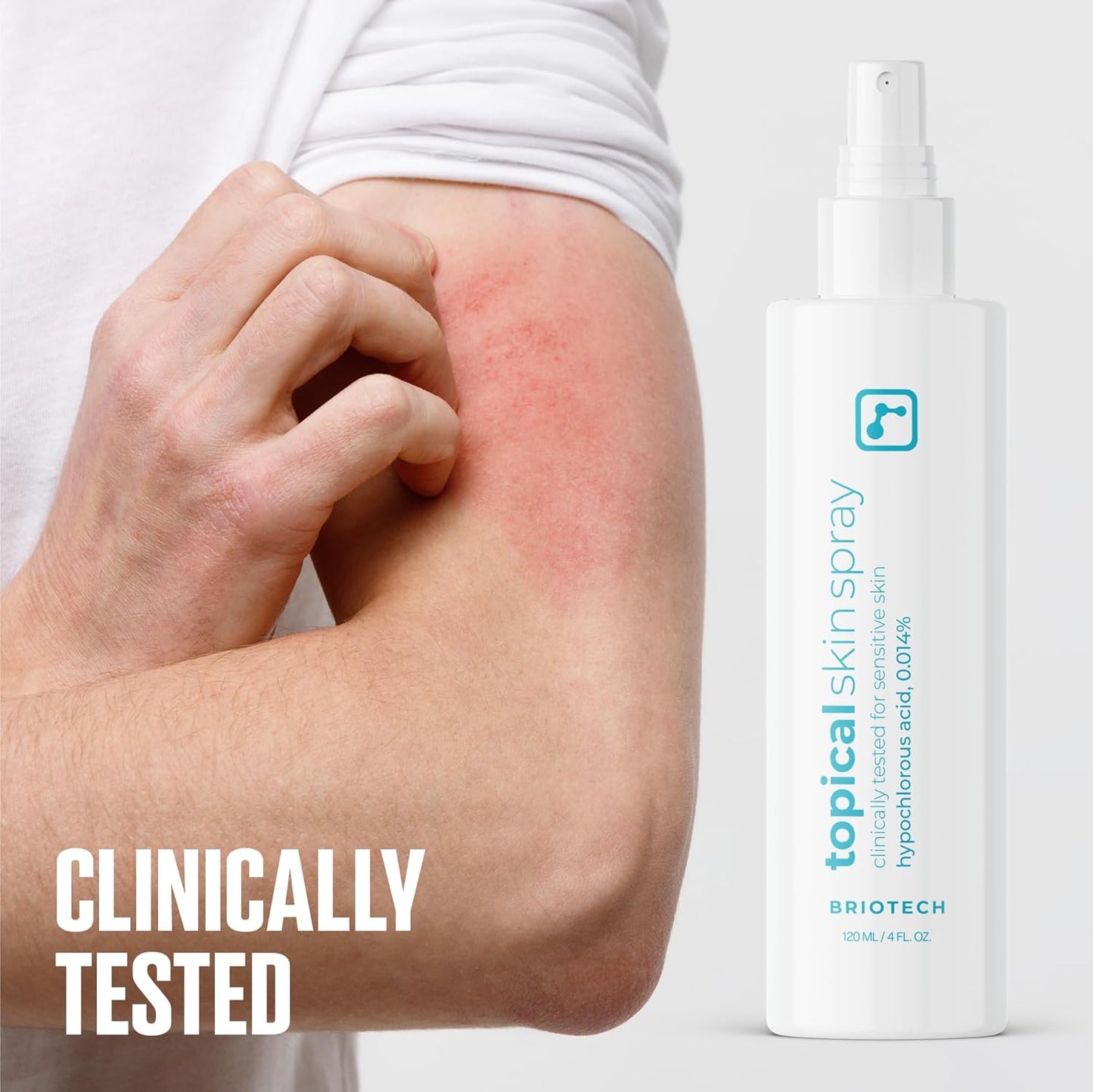BRIOTECH Hypochlorous Acid Skin Spray – 8oz Soothing Facial & Body Mist for Sensitive Skin, Redness & Irritation Relief