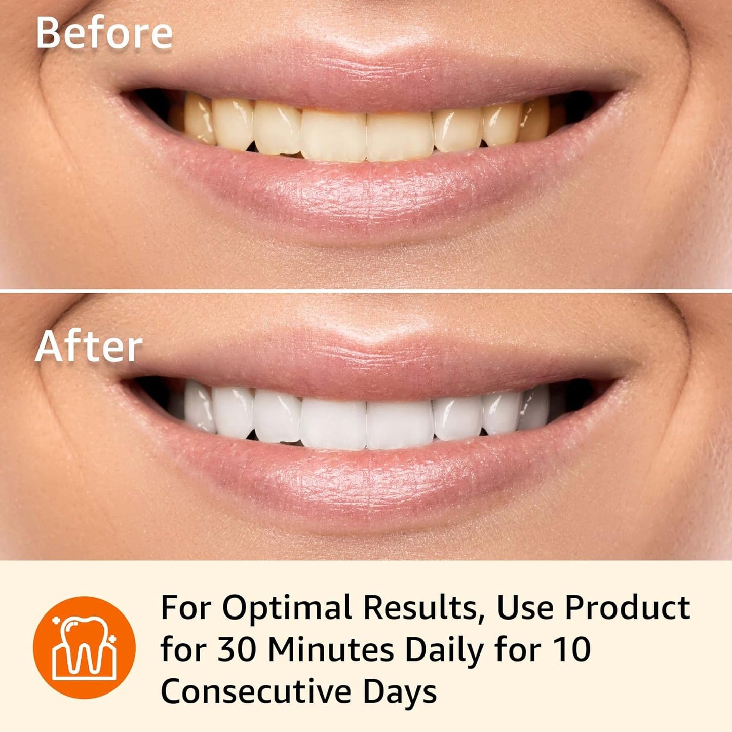 Amazon Basics 10-Day Teeth Whitening Strips Kit – Enamel-Safe, No-Slip, Easy 30-Min Whitening (20 Strips)