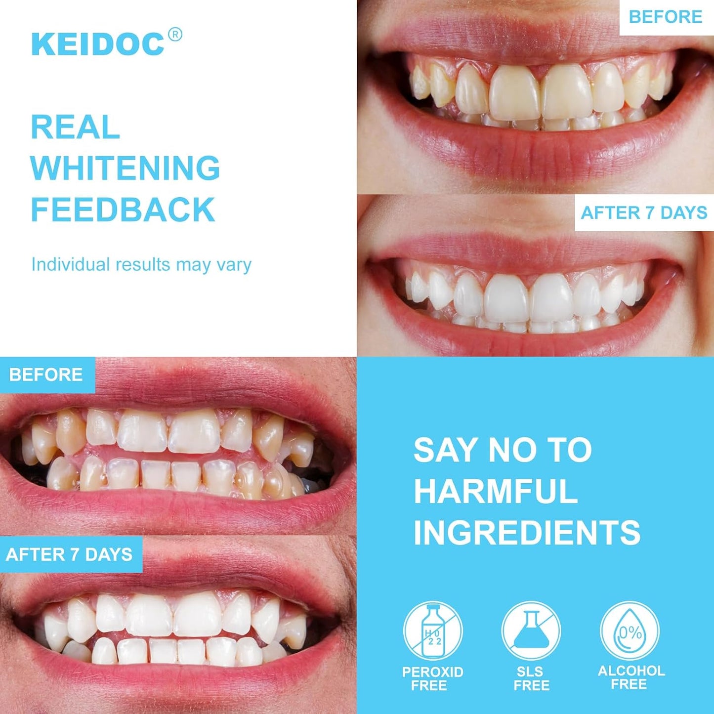 KEIDOC Coconut Oil Teeth Whitening Strips – 28 Pcs Enamel-Safe, Non-Sensitive Natural Whitening Kit (14 Treatments, Mint)