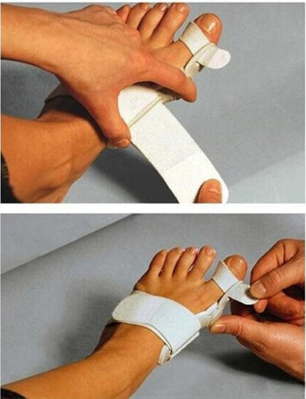 Corrector de hallux valgus LuxuryGlow: férula ajustable para juanetes con separador de dedos