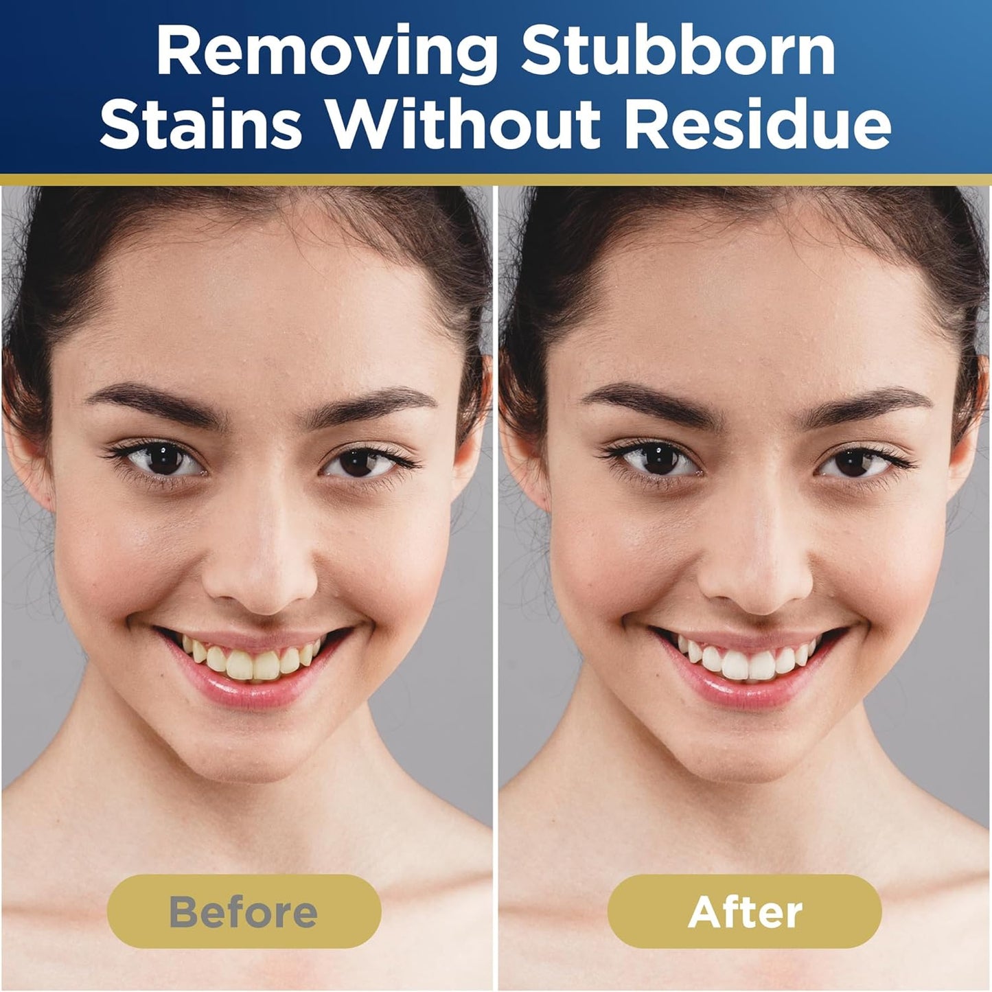 Teeth Whitening Strips – 28 Strips (14 Treatments) | Mint Flavor | Safe & Effective Whitening