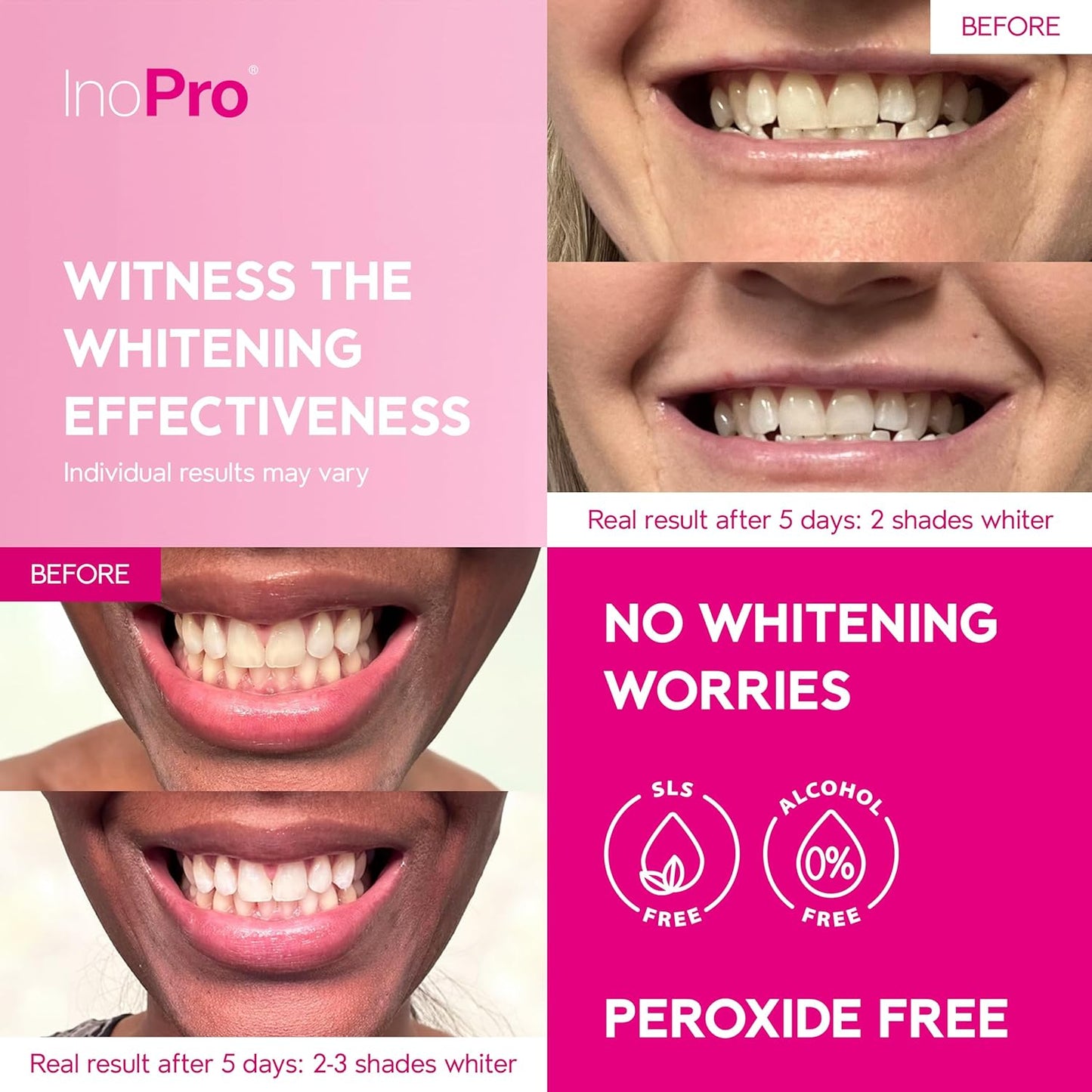 InoPro Green Teeth Whitening Strips – 14-Day Kit (28 Strips) | Peroxide-Free, Enamel Safe, Natural Stain Removal with Coconut Mint Flavor