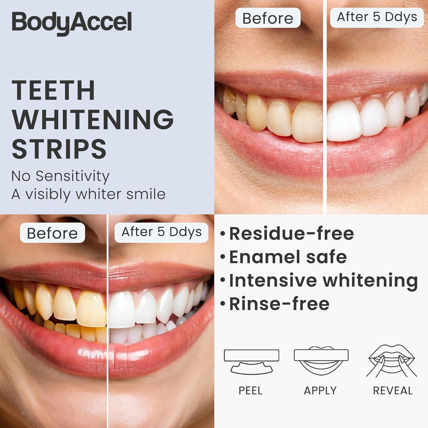 BodyAccel Teeth Whitening Strips – 7/14 Day Kit, Residue-Free, Enamel-Safe, Intensive Whitening (14 Count)