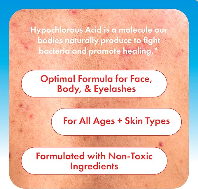 HypoClear Hypochlorous Acid Spray – Gentle HOCl Cleanser for Face, Body & Eyelids, Non-Sting Daily Toner for Acne, Redness & Sensitive Skin, 8 oz
