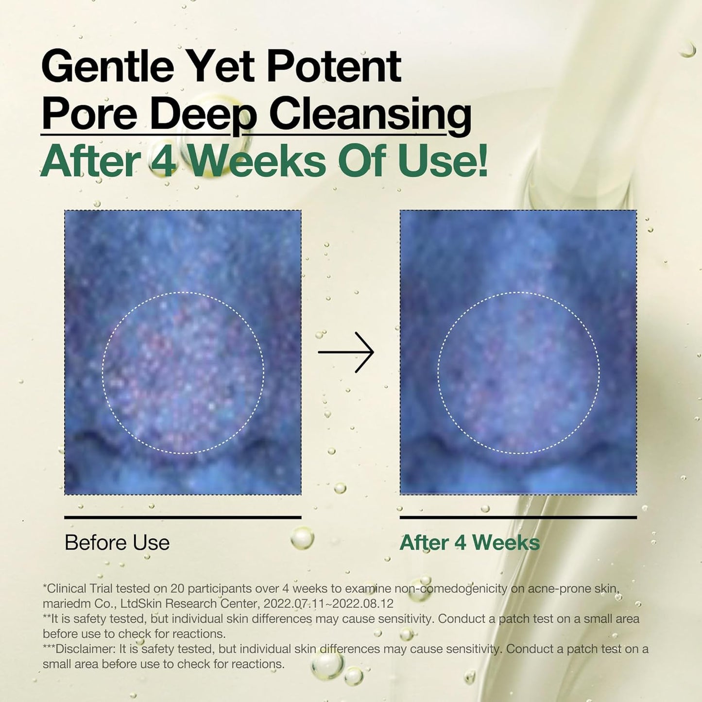 Anua Heartleaf Pore Control Cleansing Oil | Gentle Makeup & Blackhead Remover | Korean Double Cleanser for All Skin Types (200ml / 6.76 fl oz)