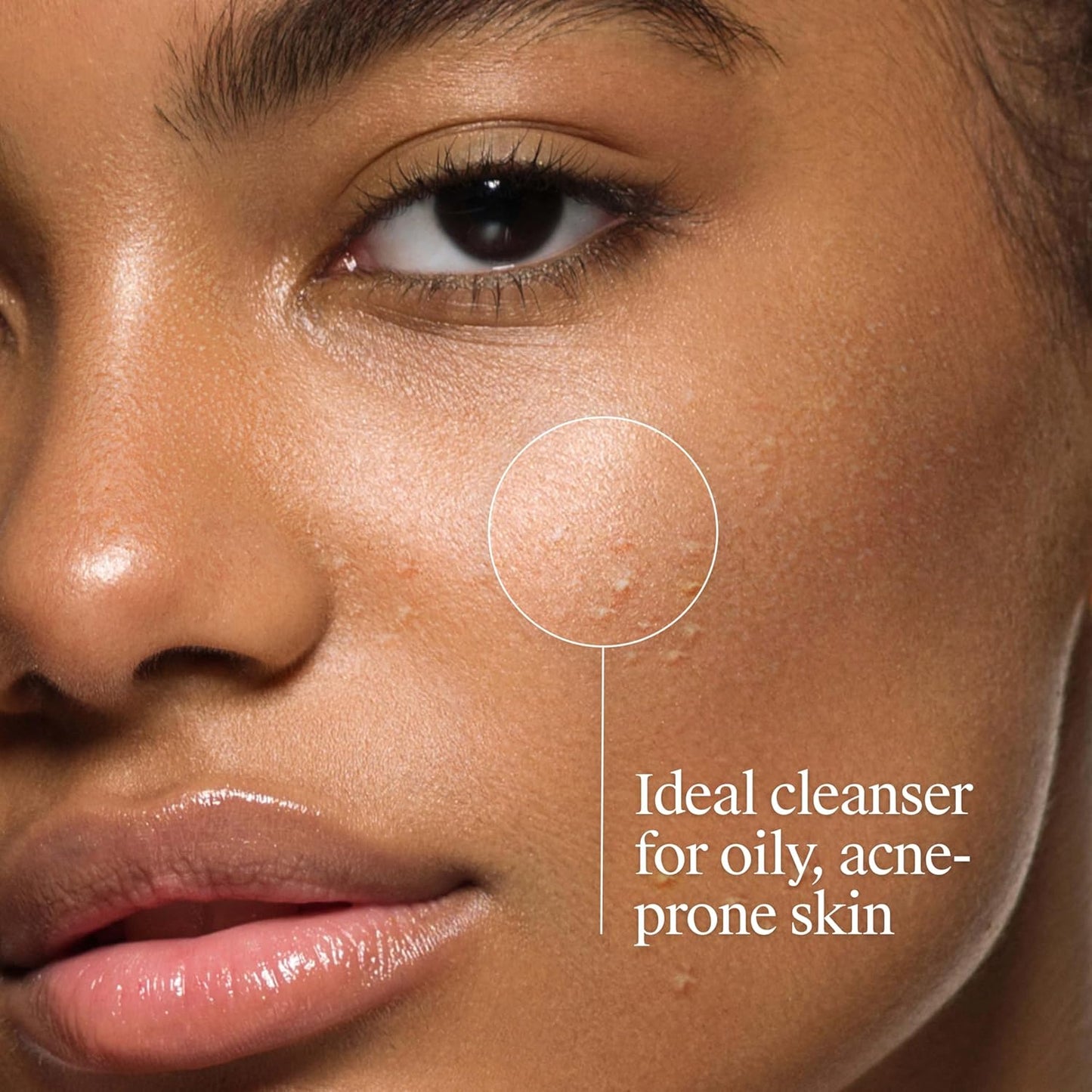 Neutrogena Oil-Free Acne Face Wash with 2% Salicylic Acid – 9.1 fl. oz