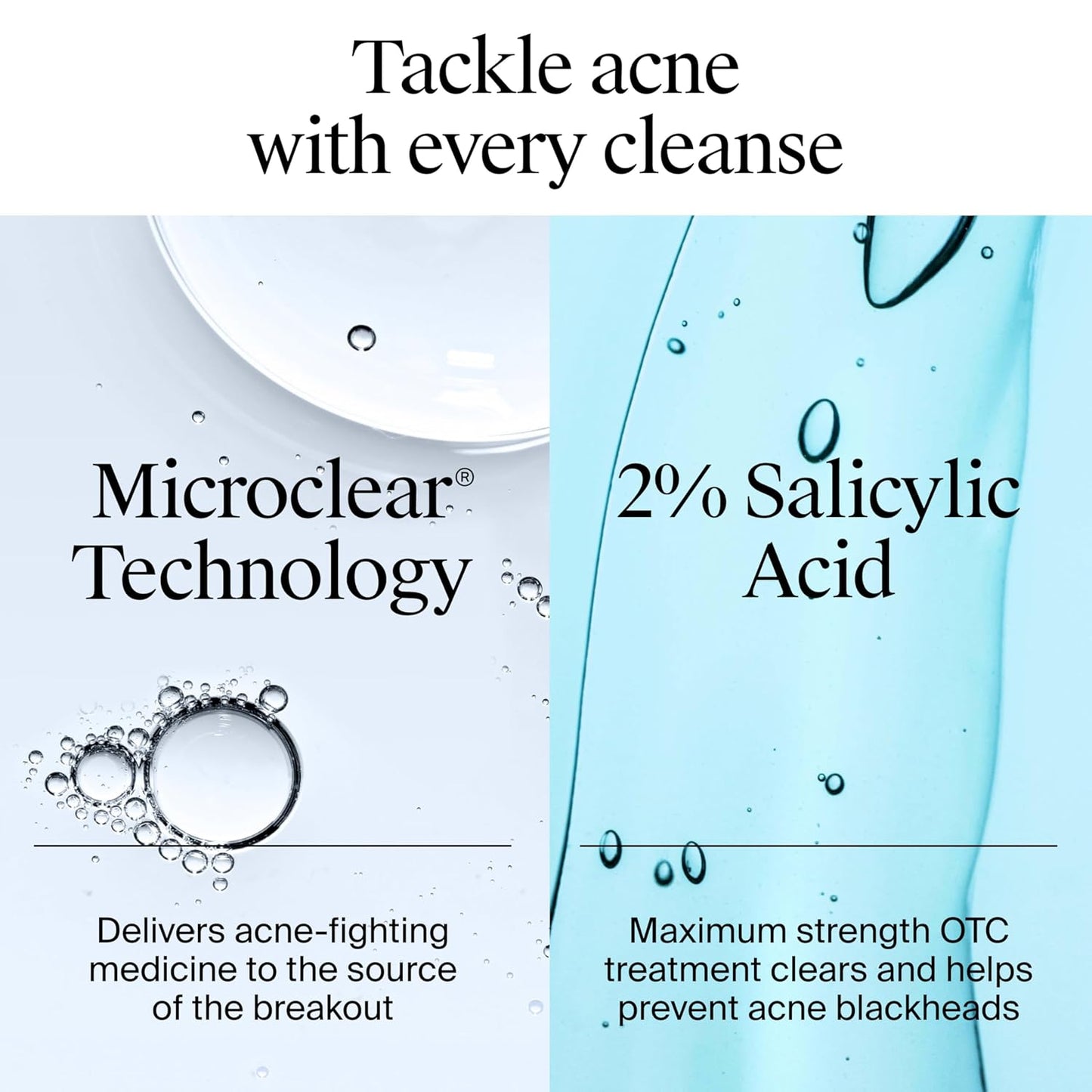 Neutrogena Oil-Free Acne Face Wash with 2% Salicylic Acid – 9.1 fl. oz