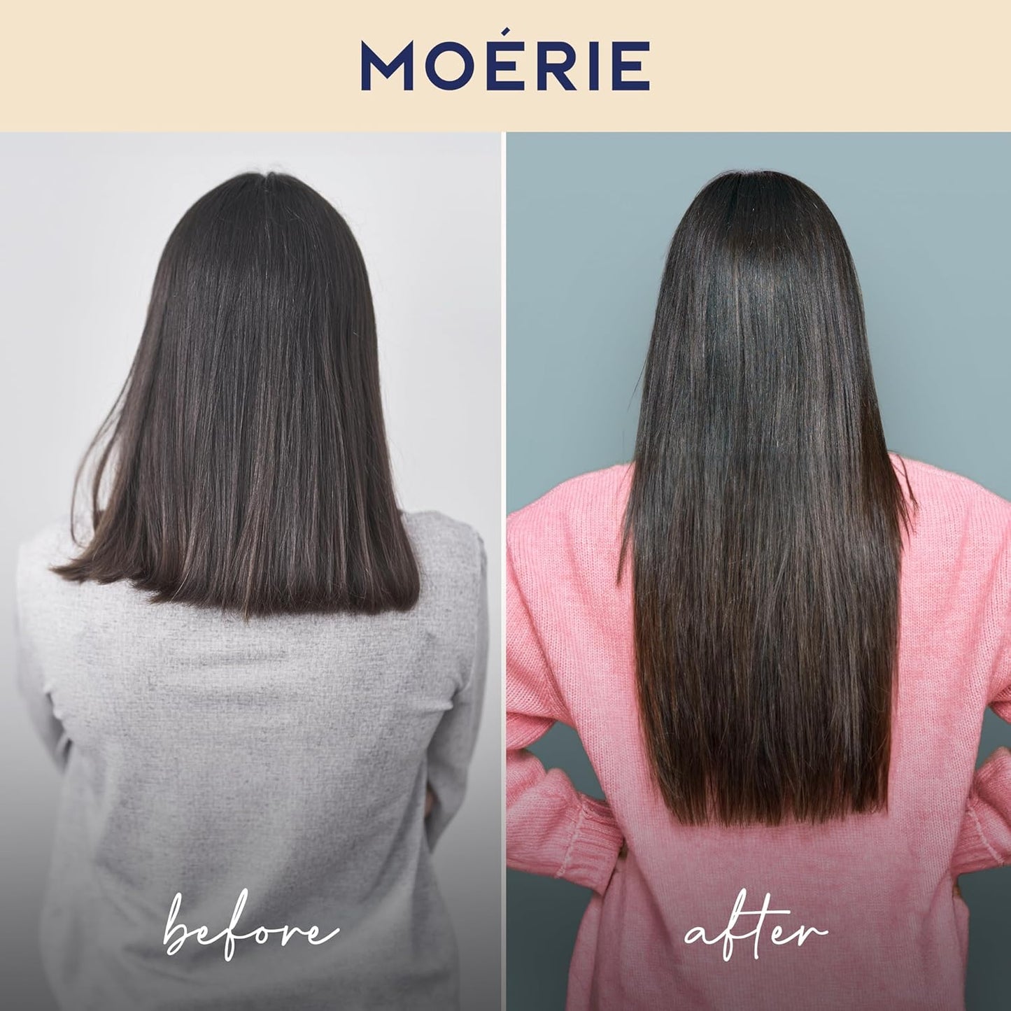Moerie Volumizing Shampoo & Conditioner Set – Natural Hair Thickening for Hair Loss with 100+ Active Nutrients – Sulfate-Free, 2 x 8.45 fl oz