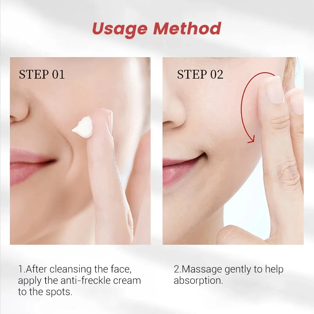 EELHOE Freckle Removal Cream – Brightening Dark Spot Corrector & Anti-Pigmentation Face Moisturizer (20g)