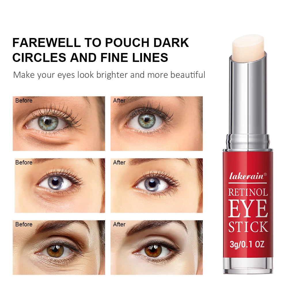 Crema de ojos con retinol en barra ibcccndc: suero iluminador y antiedad para ojeras (3 g)