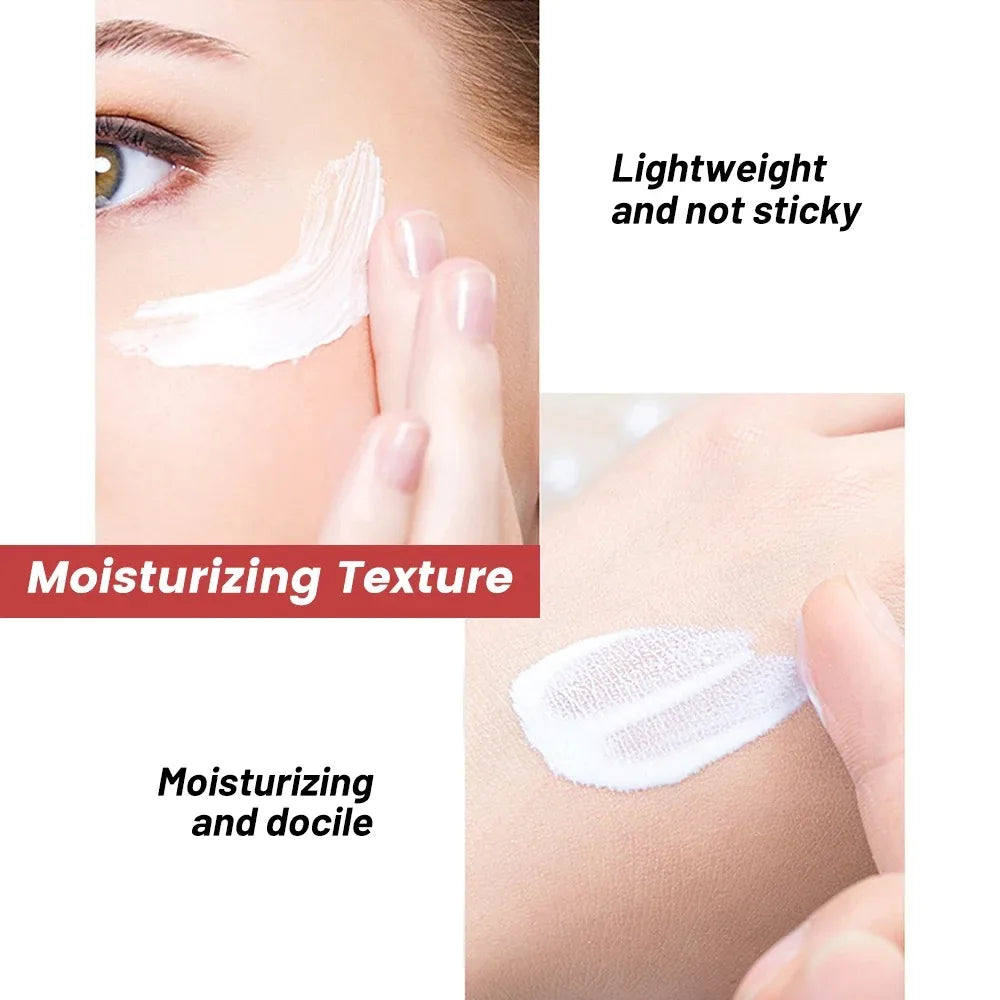 EELHOE Freckle Removal Cream – Brightening Dark Spot Corrector & Anti-Pigmentation Face Moisturizer (20g)