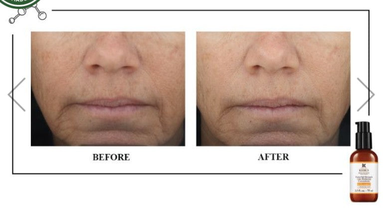 Powerful Strength Line Reducing Concentrate – Vitamin C Anti-Aging Serum with Hyaluronic Acid for Radiant, Smooth Skin