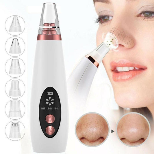 LuxuryGlow Rechargeable Blackhead Remover Vacuum – Deep Pore Cleanser & Acne Extractor
