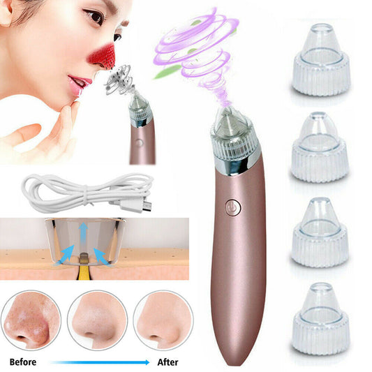 جهاز إزالة الرؤوس السوداء الكهربائي من LuxuryGlow - 4 رؤوس، أداة تنظيف المسام بمنفذ USB