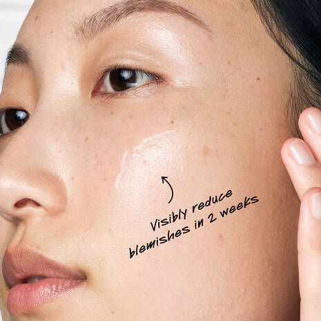 Ultra Pure High-Potency 5% Niacinamide Serum for Oily & Acne-Prone Skin – Shine Control & Pore Refining Formula